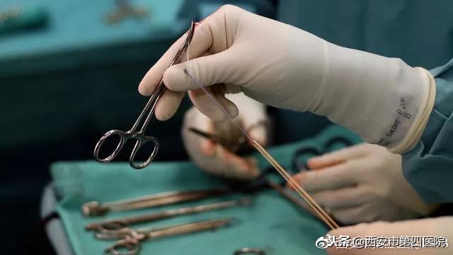 什么叫面肌痉挛,非典型面肌痉挛如何治疗