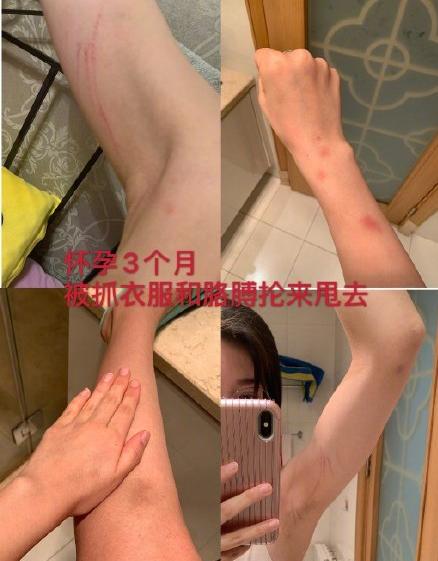 没有最虐只有更虐,没有最糟只有更糟