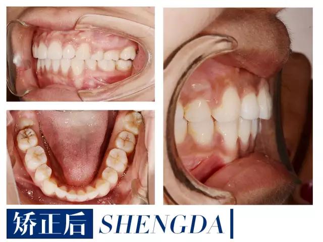 山西“爱马仕”级别齿科医院！get明星同款笑容