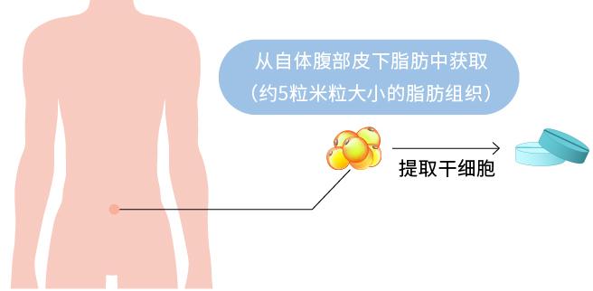 为什么干细胞成为治疗关节疼痛的最佳选择，来看看这些实例