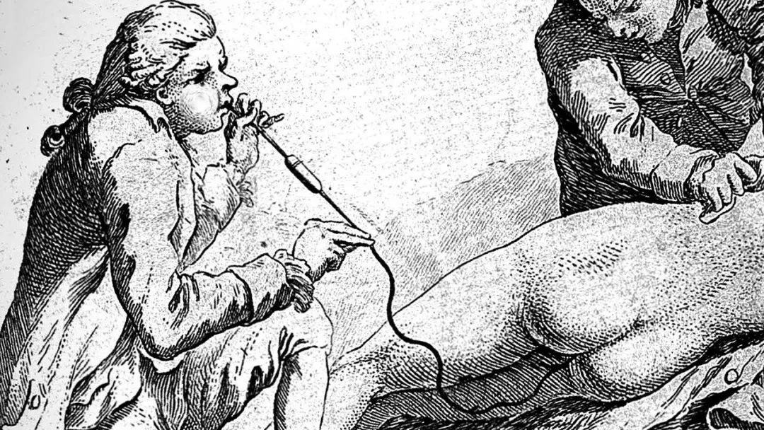 捅菊、放血、灌肠、*脑洗**……这些黑医术，你能扛过哪一招