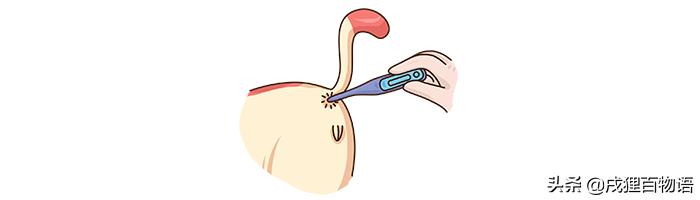 猫咪大便不正常怎么回事,猫咪屁屁老是有稀便便是怎么回事