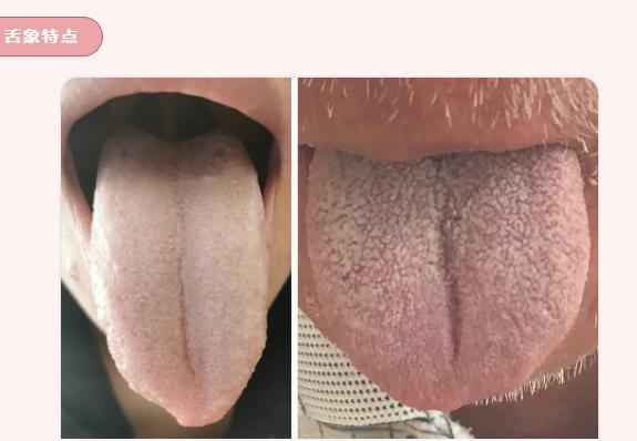 脸色暗沉如何艾灸,面色萎黄艾灸腰部