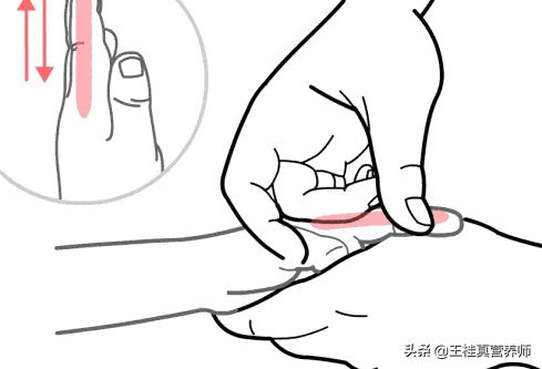 宝宝脸上一般会出现什么,孩子脸上4种特征