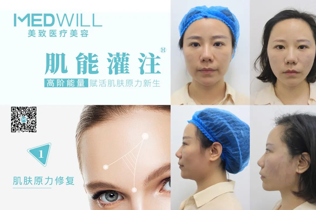 对话｜甄蒂：医美行业适合盛产美女的城市