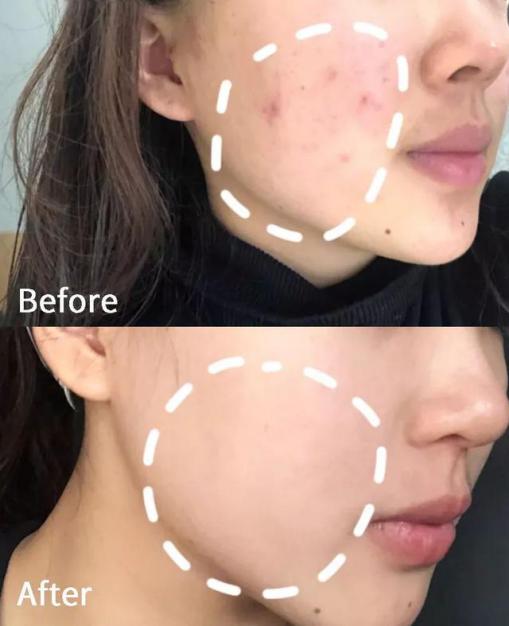 大长今宋慧乔金喜善,大长今金喜善宋慧乔