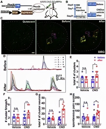 Neuron：董欣中/张俊明合作揭示神经损伤后自发性疼痛产生新机制
