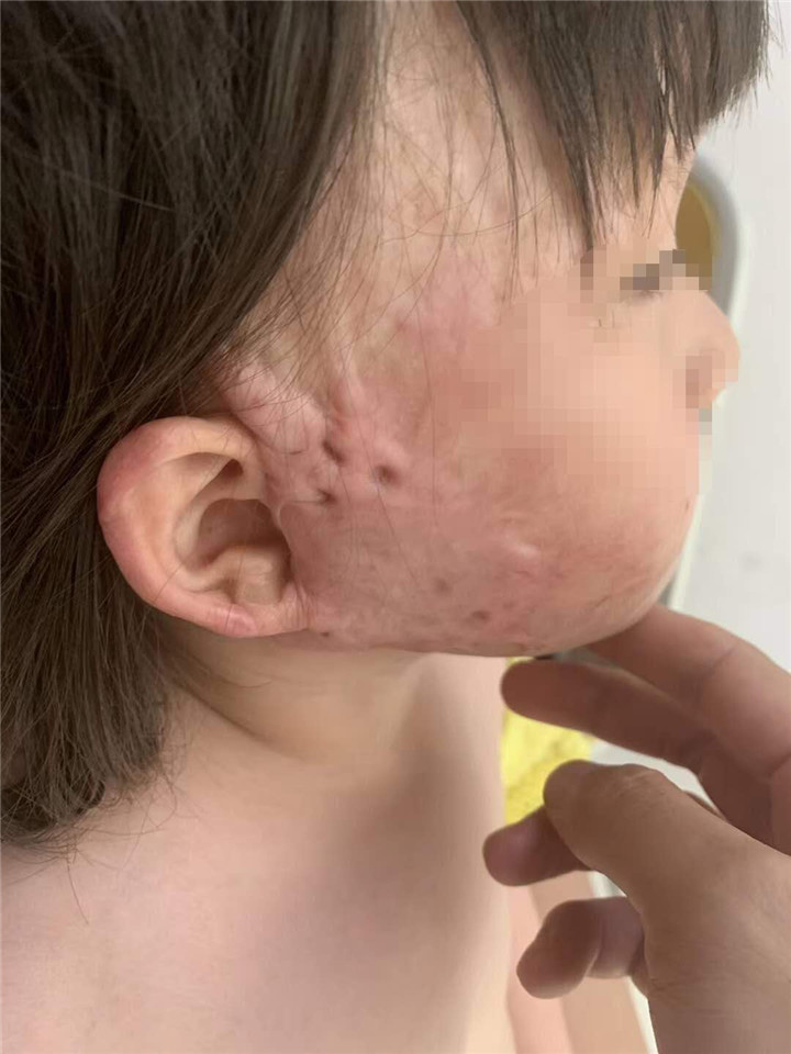 贵阳烧伤烫伤专科医院,贵阳烧伤医院医生简介