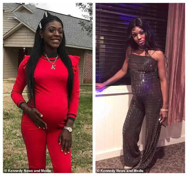 最美胎记，姐姐在胎中被弟弟“吸收”，将B超影像留在了弟弟腿上