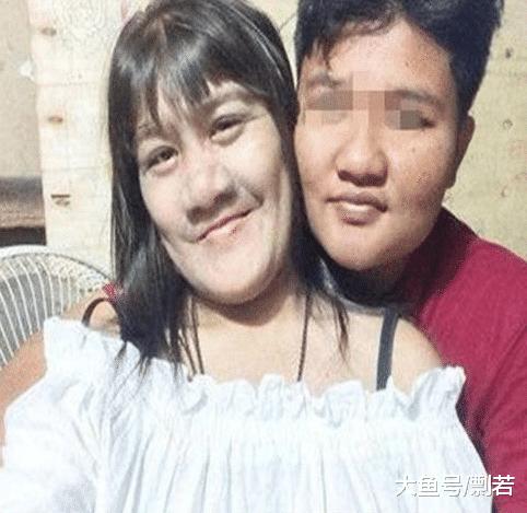 女孩身患“怪病”脸上长毛，男友原本不离不弃，剃发后竟然淡定不了？