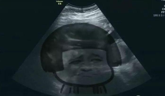 一周没来大姨妈是不是怀孕了,月经晚了一个星期没测出怀孕