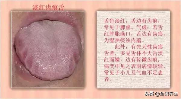 月经周期注意事项,注意经期健康图片