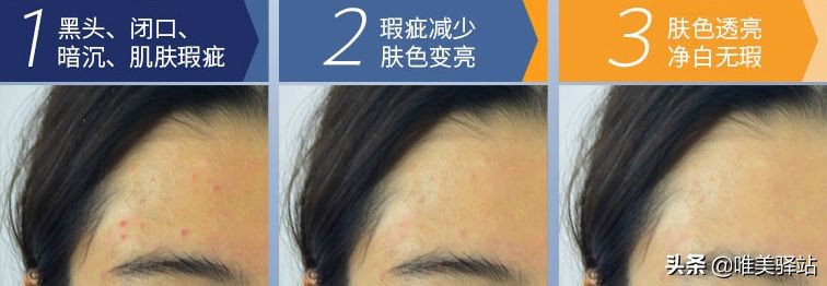 sk美白精华小灯泡,美白精华小灯泡skii