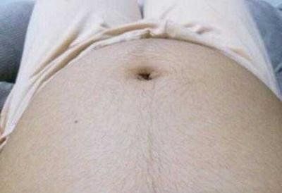 怀孕肚子上长毛变黑怎么回事,怀孕后肚子上长毛怎么回事