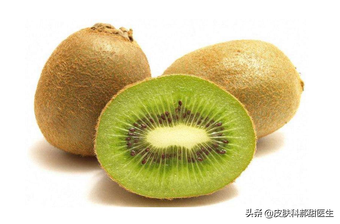 缺铁会脱发吗,产后脱发跟缺铁有关系吗