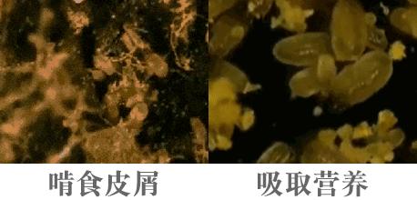 黑头粉刺毛孔粗大螨虫怎么去除,去黑头粉刺螨虫痘痘深层毛孔清洁