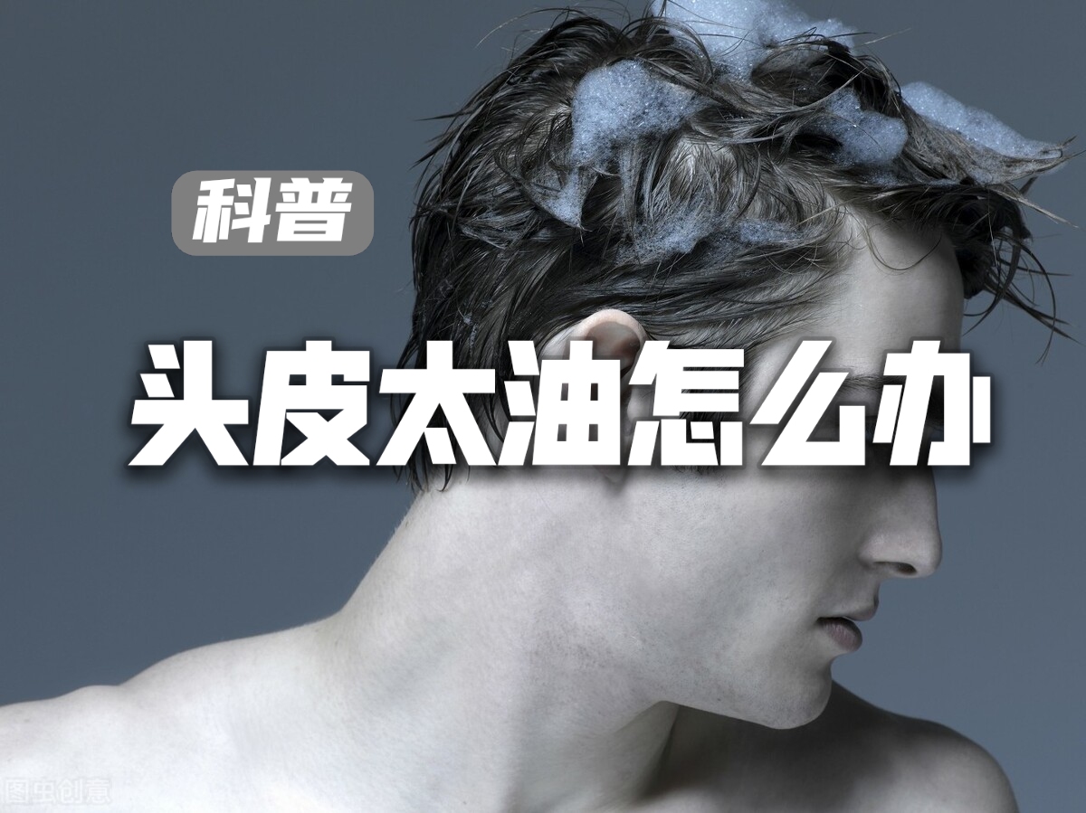头皮爱出油教你几个小方法,男士头皮出油用什么洗发水控油