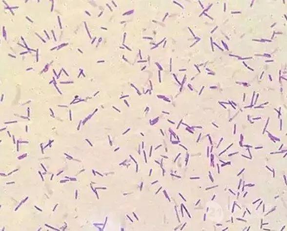 简单易懂的益生菌知识大全,微生物细菌小知识