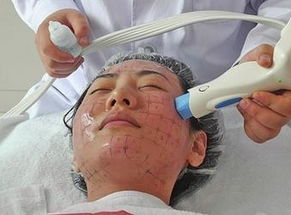 亳州利辛县热玛吉除皱术,亳州热玛吉除皱术