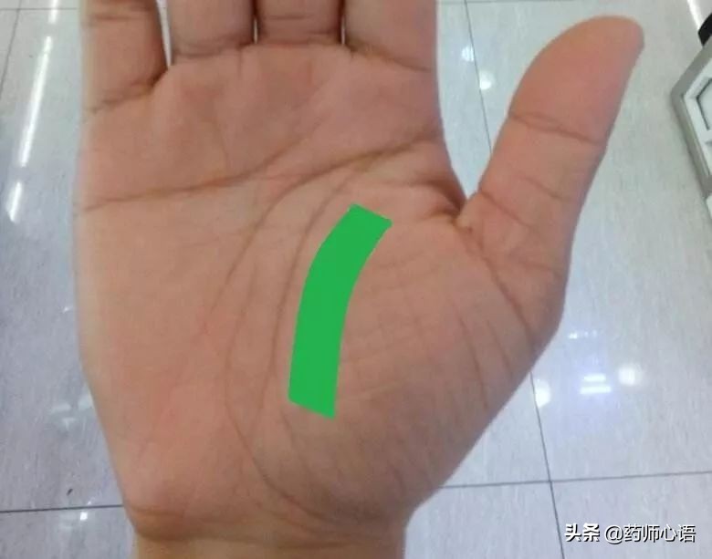 手上的健康秘密,手的颜色能看出健康的问题吗