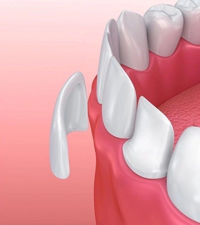 王鸥打瘦脸针真的假的,王鸥真的打过瘦脸针吗