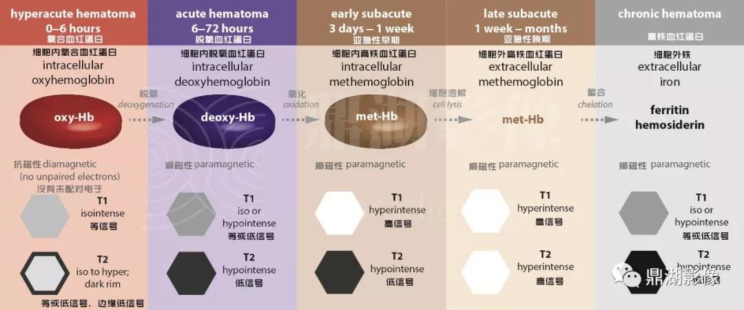 不简单|脑出血超详细学习笔记