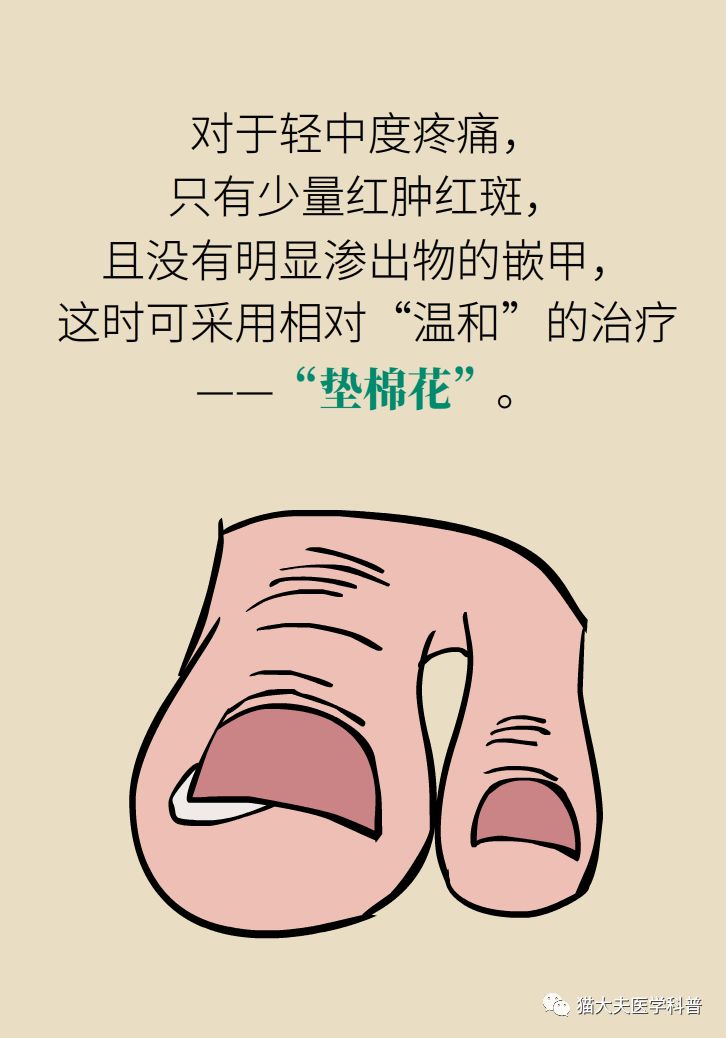 脚趾甲往肉里长怎么治除根,脚趾甲长在肉里面治疗视频