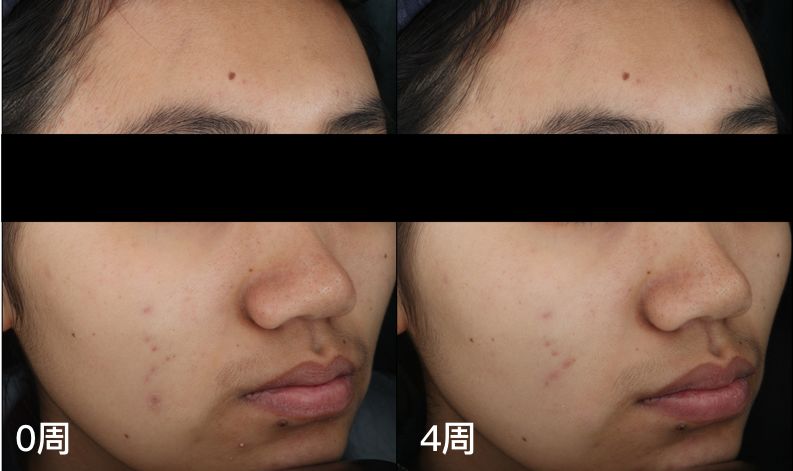 平价护肤品vs贵妇护肤品,平价护肤品和高端化妆品