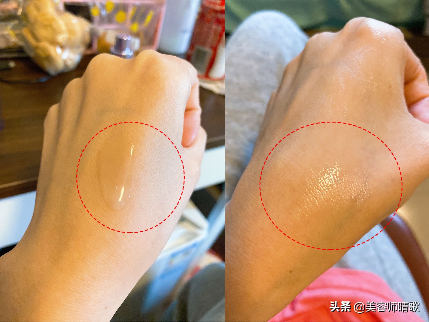 小白瓶淡斑精华推荐,淡斑小白瓶精华