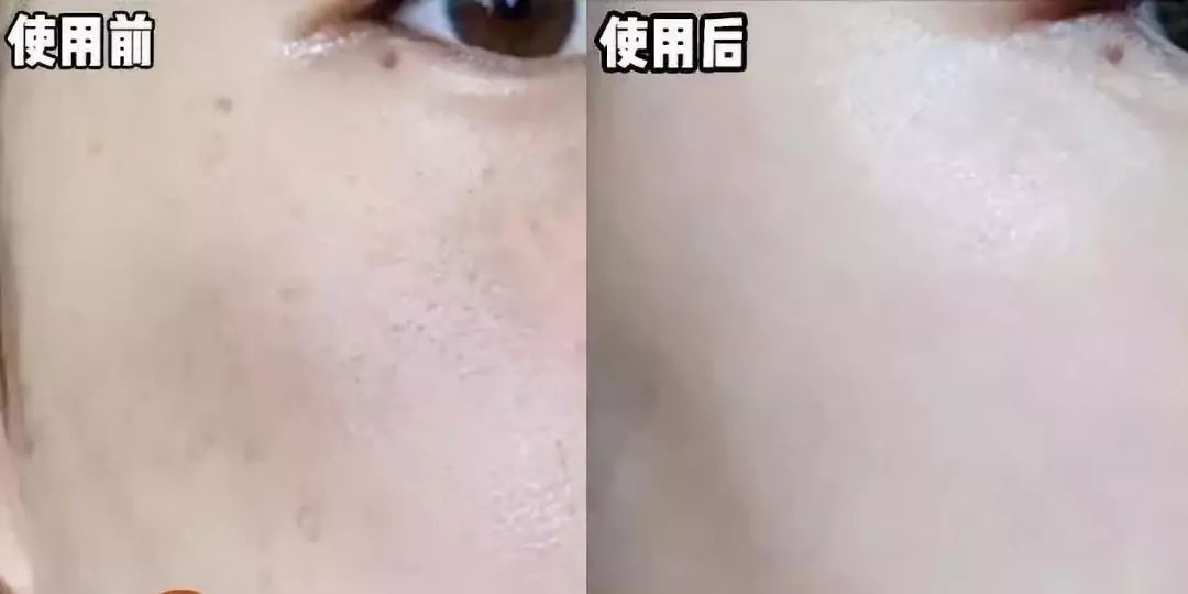 怎样敷水光面膜,明星每天敷面膜