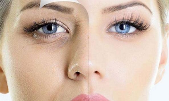 艾诗摩尔眼部护理润眼仪,拿什么拯救你我的皱纹