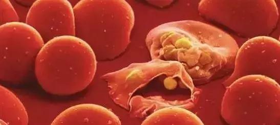 青蒿素屠呦呦红斑狼疮,屠呦呦青蒿素治疗红斑