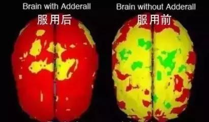 “聪明药”年销超80亿片！现在正把魔爪伸向中国...