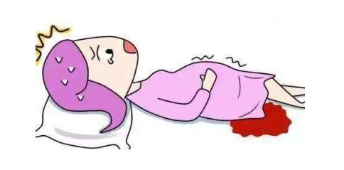 宫外孕大失血出血量,宫外孕大出血一年后还贫血