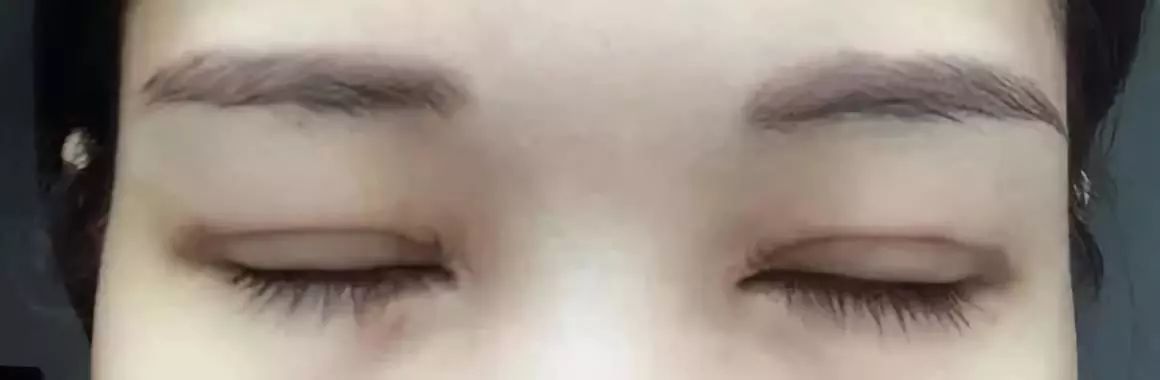 请别再怀疑潘贰做双眼皮手术切肌肉了，希望这是我最后一次澄清