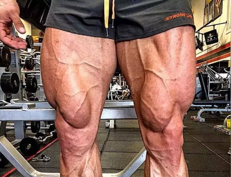 腿部拉筋可以改变腿型吗,腿部训练可以纠正腿型