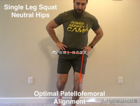 运动康复膝关节疼痛解决,下髌骨关节疼痛综合征