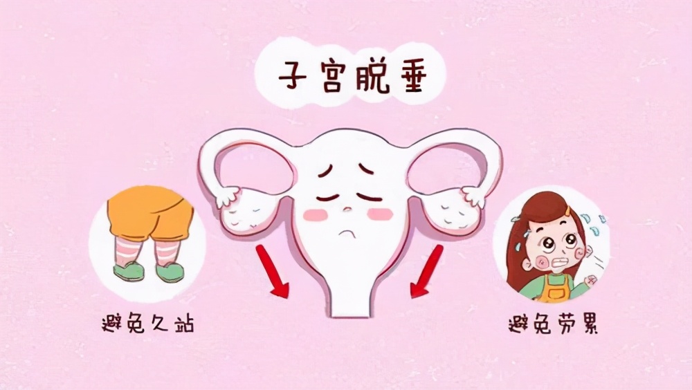 怀孕2个月发现子宫脱垂,怀孕晚期子宫脱垂到外阴