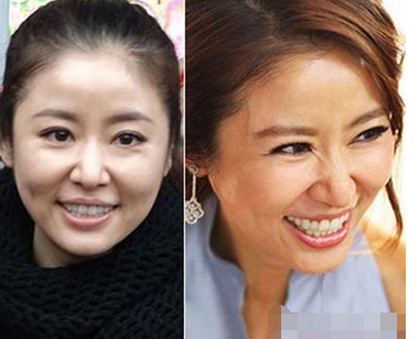 去细纹的电动眼霜,能熨平皱纹的眼霜