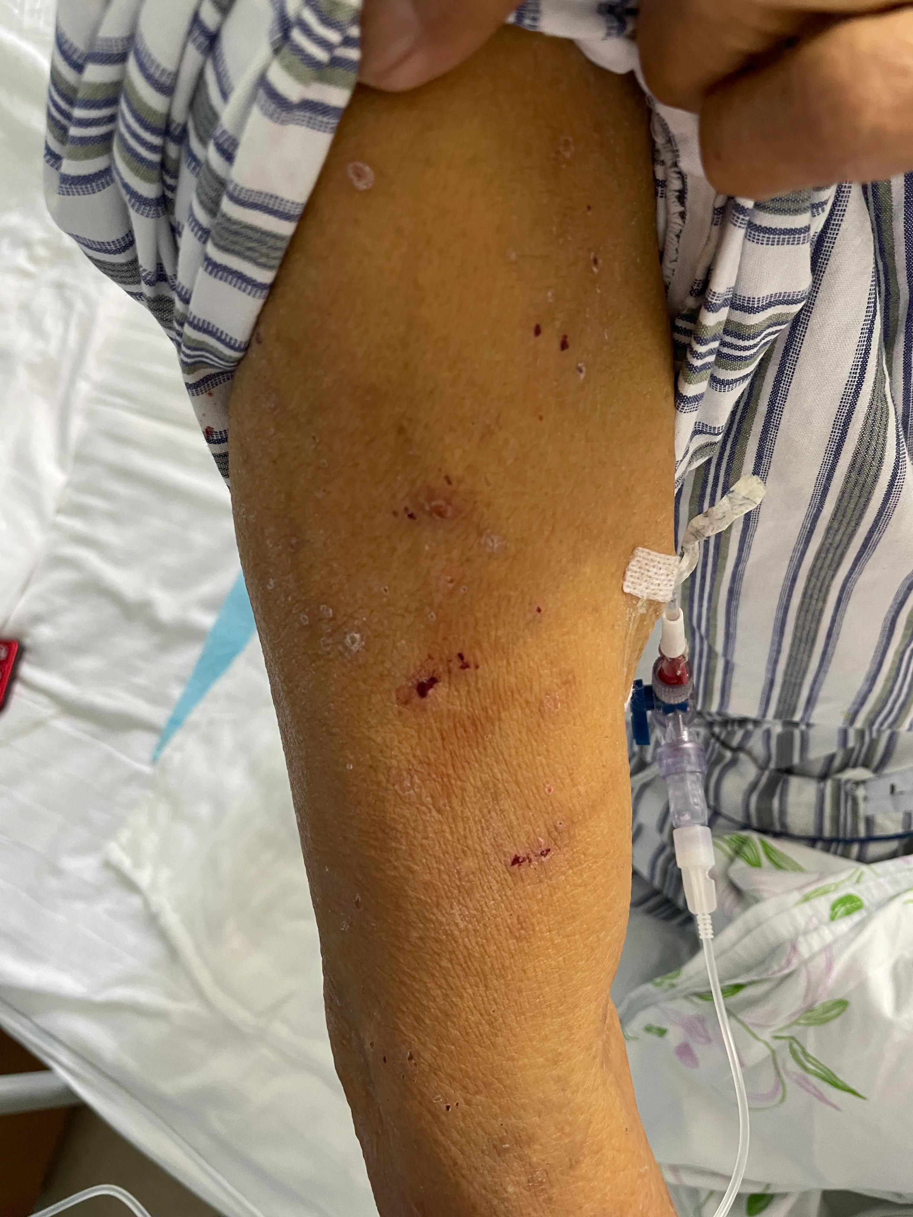 面黄眼黄尿黄是什么原因,眼黄尿黄吃什么好