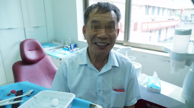 老年人半口缺牙有几种修复方法,老年人大部分缺牙的最佳治疗方法