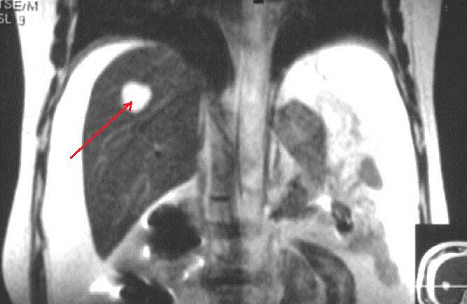 什么是癌症病理学,什么是癌症中医治疗