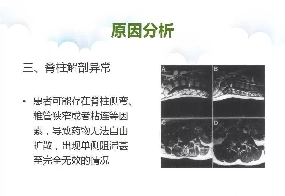 腰麻后不出脑脊液怎么办,腰麻脑脊液抽不出来