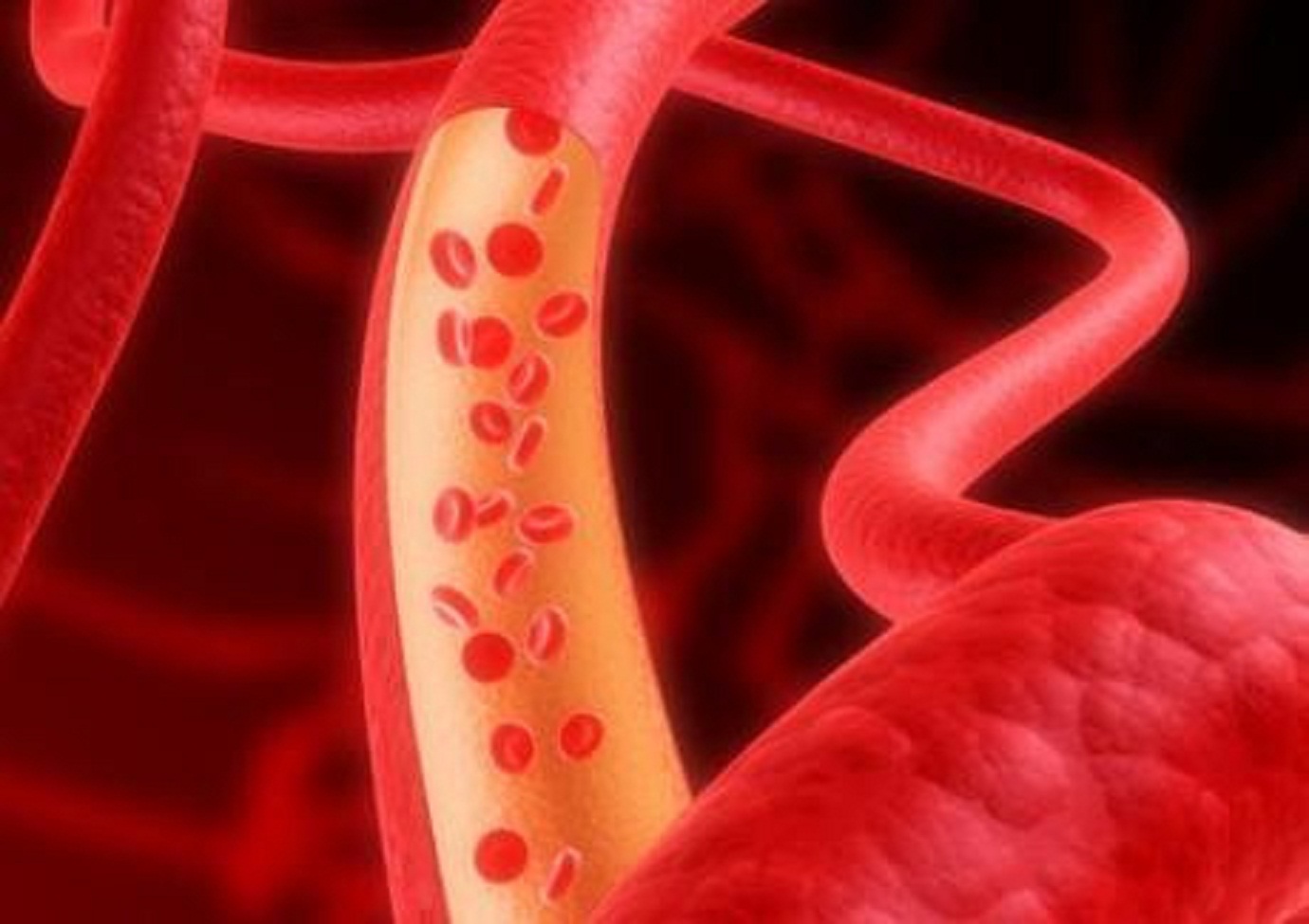 甘油三酯高会引起皮肤发黑吗,甘油三酯高流血后出的血偏白色