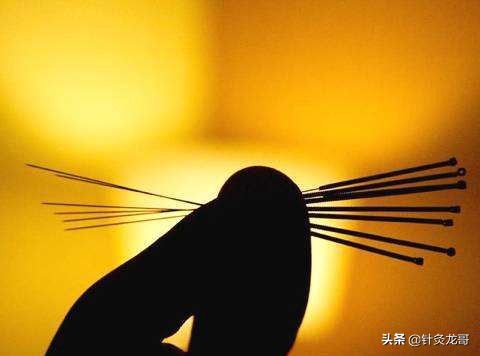 回阳九针的视频,回阳九针穴针灸视频