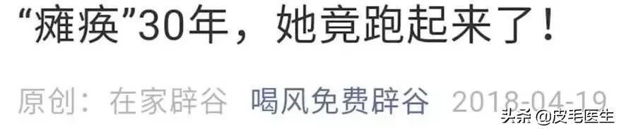喝中药治疗荨麻疹反而严重了,防风能治荨麻疹吗
