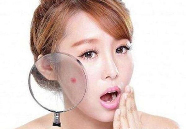 换季混油皮脸干到爆皮怎么办,干性皮肤脸出油护理