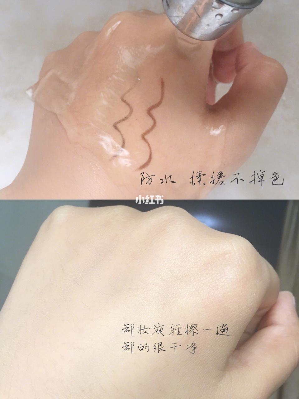 肿眼泡内双怎样贴出宽大双眼皮,肿眼泡内双眼皮怎么整形