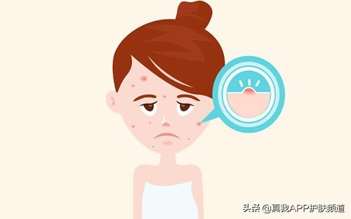 香皂洗脸毁脸吗,香皂洗脸的好处与坏处