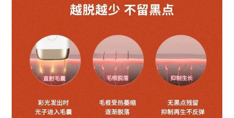 j-style脱毛仪测评,j-style美容仪好用吗